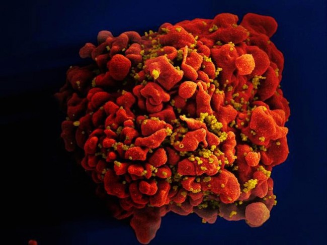Les scientifiques découvrent un nouveau moyen de bloquer le VIH