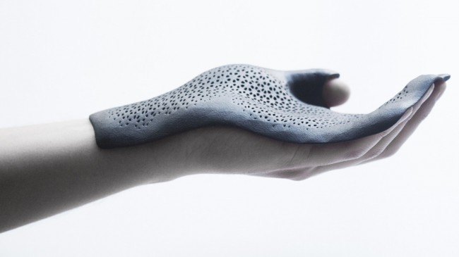 Votre prochaine prothèse de main pourrait être imprimée en 3D